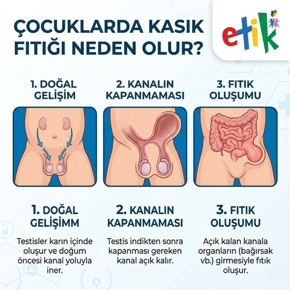 Ã§ocuklarda kasÄ±k fÄ±tÄ±ÄŸÄ± ameliyatÄ± sonrasÄ±