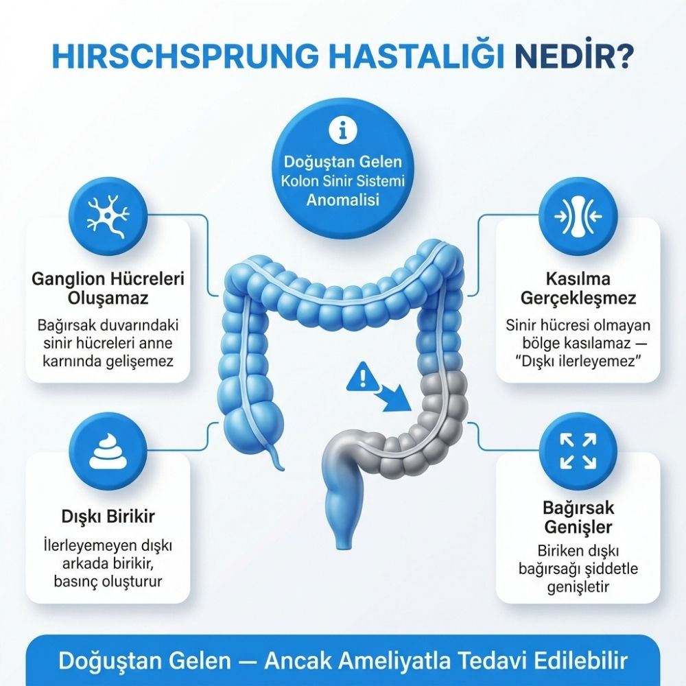 hirschsprung hastalÄ±ÄÄ±