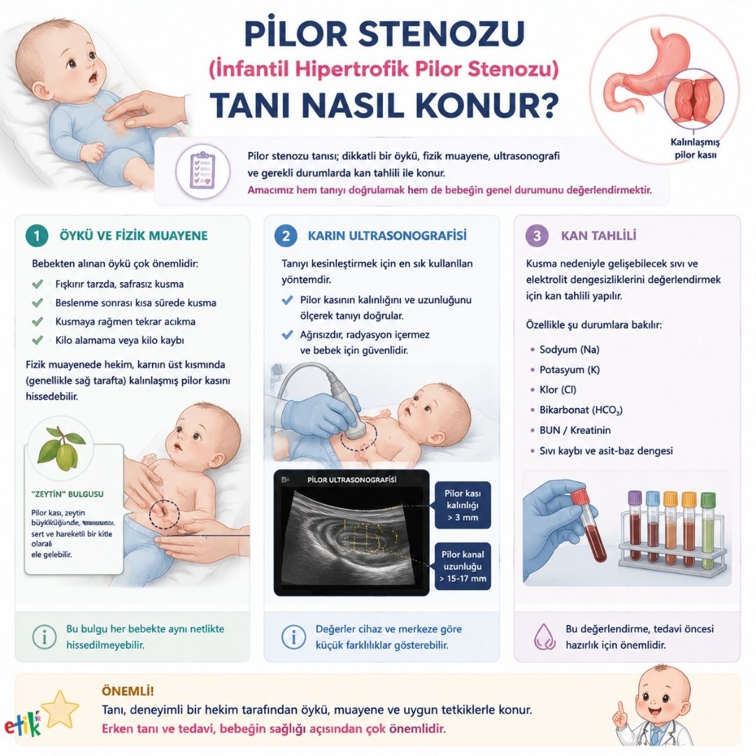 Pilor stenozu tanÄ±sÄ±